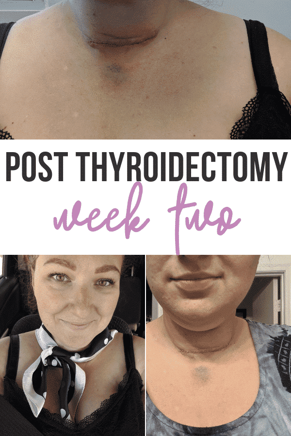 Thyroid Surgery Scar After Removal (Care & Pictures) - Healthy with Jamie