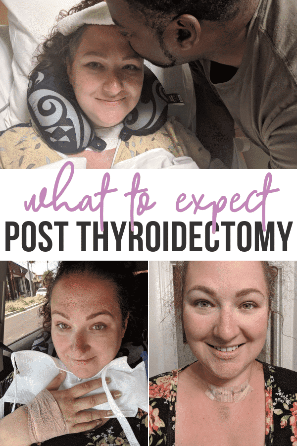 thyroidectomy what to expect