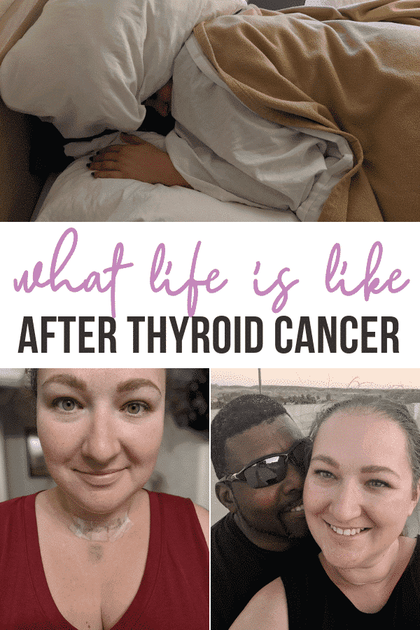 Thyroidectomy Hell Life After Thyroid Cancer Sadie Smiley